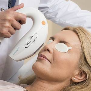 Фотолечение пигментных пятен – IPL-терапия